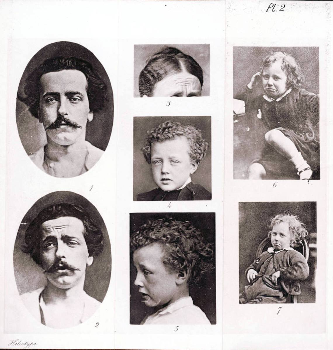 plate_depicting_emotions_of_grief_from_charles_darwins_book_the_expression_of_the_emotions